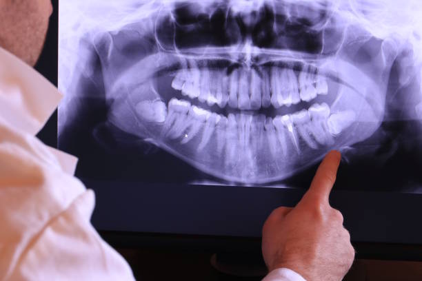 Best Urgent Dental Care for Toothaches in Middletown, CA